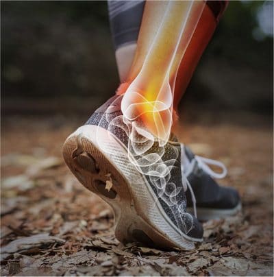 Ankle Pain Image